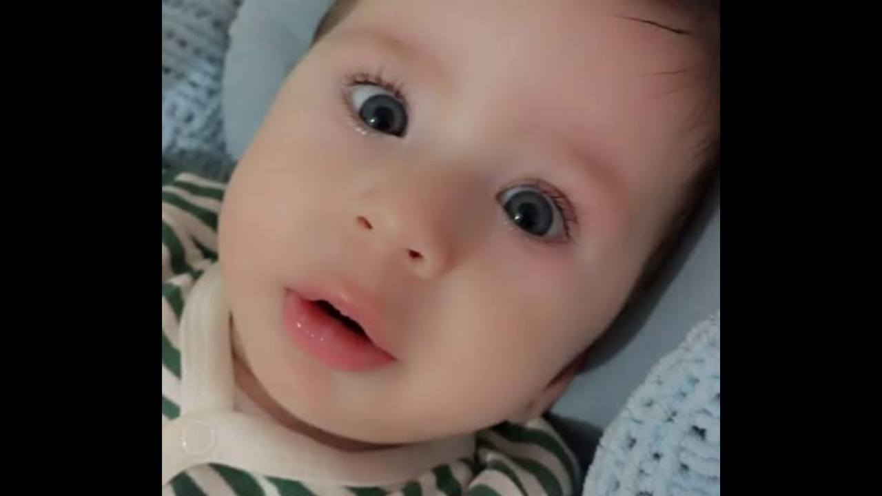 Bodrum’da yaşayan ve Spinal Müsküler Atrofi (SMA) Tip 1 teşhisi